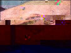 Mr Bowen needed surgery and physiotherapy to help him walk again