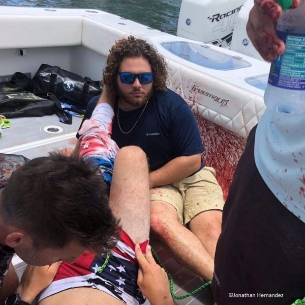 Jonathan-Hernandez-Bahamas-Shark-attack-.jpg