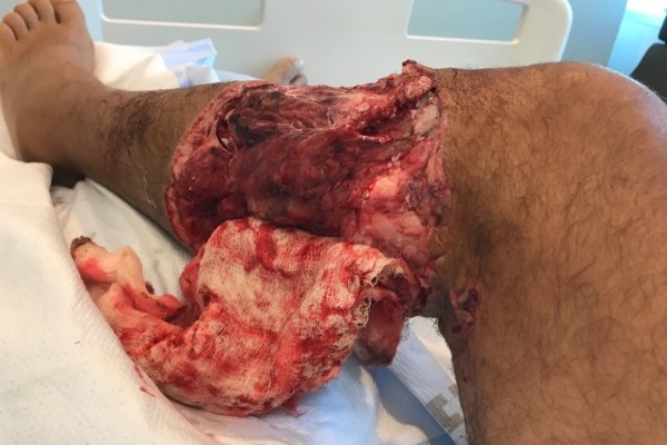 pain killer shark attack.jpeg