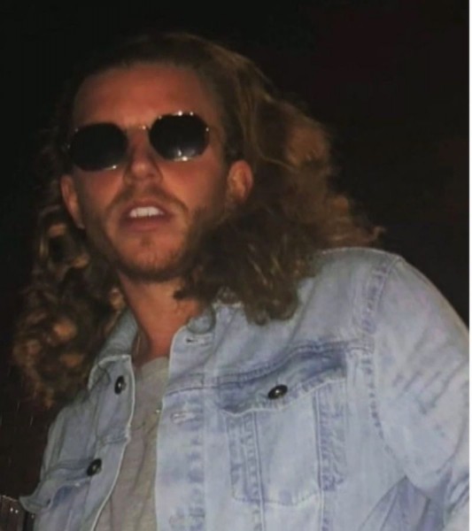 Alistair Raddon, 28, had his right foot bitten off