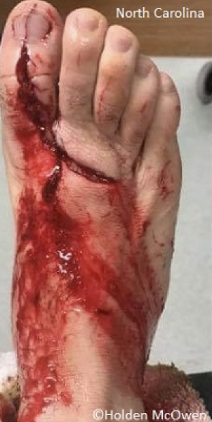 Samuel horne shark attack.png